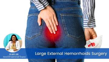 Dr Amita Jain is the best large External Hemorrhoids Surgeon